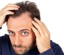 2021 Popüler Saç Ekimi Merkezleri Fiyatları