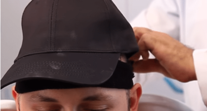 Saç Ekimi Sonrası Kask, Şapka, Baret vb. Takmak